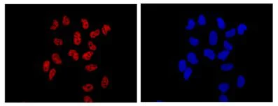 Immunocytochemistry/ Immunofluorescence - Anti-PHOX2B antibody [EPR14423] - BSA and Azide free (AB216456)