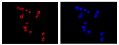 Immunocytochemistry/ Immunofluorescence - Anti-PHOX2B antibody [EPR14423] - BSA and Azide free (AB216456)