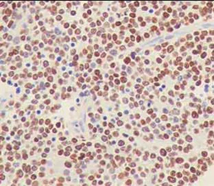 Immunohistochemistry (Formalin/PFA-fixed paraffin-embedded sections) - Anti-PHOX2B antibody [EPR14423] - BSA and Azide free (AB216456)