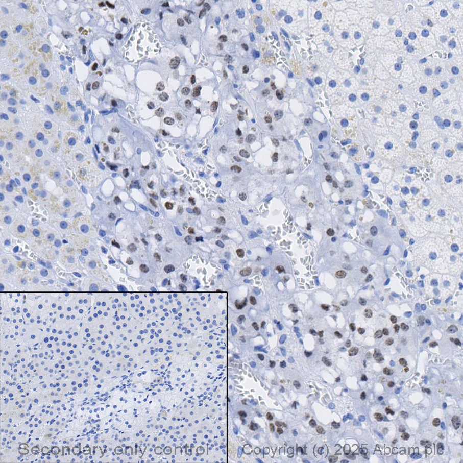 Immunohistochemistry (Formalin/PFA-fixed paraffin-embedded sections) - Anti-PHOX2B antibody [EPR14423] - BSA and Azide free (AB216456)