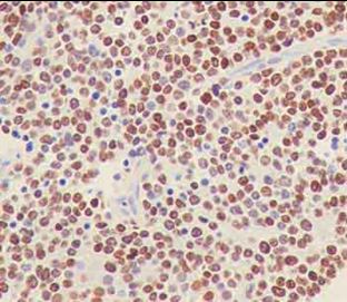Immunohistochemistry (Formalin/PFA-fixed paraffin-embedded sections) - Anti-PHOX2B antibody [EPR14423] - C-terminal (AB183741), expandable thumbnail