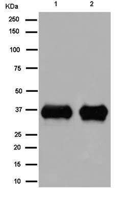 Western blot - Anti-PHOX2B antibody [EPR14423] - C-terminal (AB183741)