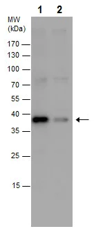 Western blot - Anti-PHOX2B antibody - N-terminal (AB227719)