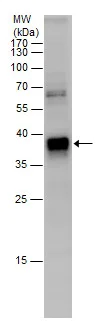 Western blot - Anti-PHOX2B antibody - N-terminal (AB227719)