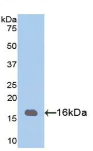 Western blot - Anti-PHPT1 antibody (AB231908)