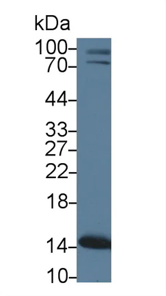 Western blot - Anti-PHPT1 antibody (AB231908)