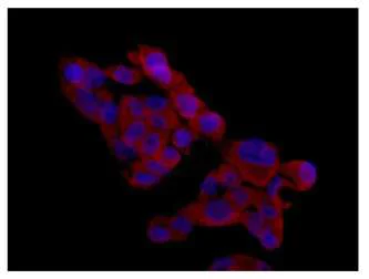 Immunocytochemistry/ Immunofluorescence - Anti-PHYHD1 antibody [EPR13313(B)] - BSA and Azide free (AB250730)