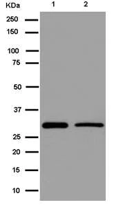 Western blot - Anti-PHYHD1 antibody [EPR13313(B)] - BSA and Azide free (AB250730)