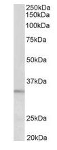 Western blot - Anti-PI-15 antibody (AB133172)