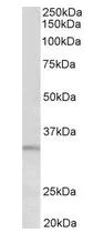 Western blot - Anti-PI-15 antibody (AB133172)
