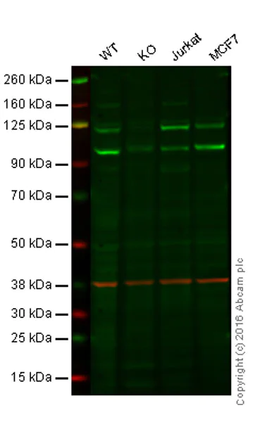 Western blot - Anti-PI 3 Kinase catalytic subunit alpha/PIK3CA antibody [EP383Y] (AB40776)
