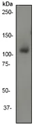 Western blot - Anti-PI 3 Kinase catalytic subunit alpha/PIK3CA antibody [EP383Y] (AB40776)