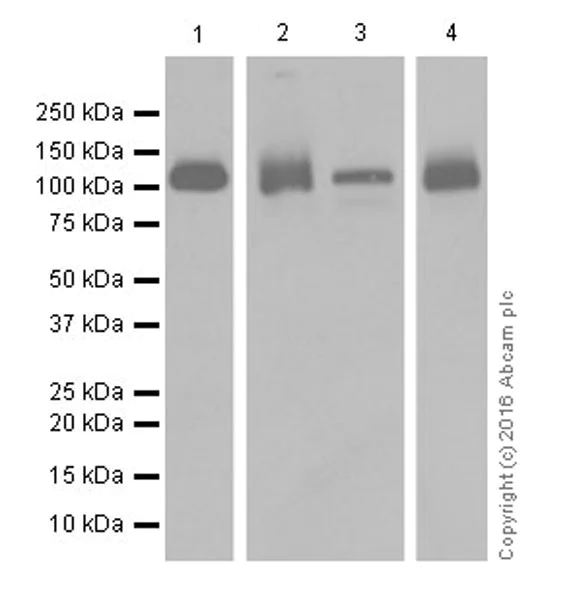 Western blot - Anti-PI 3 Kinase catalytic subunit alpha/PIK3CA antibody [EPR19693] (AB183957)