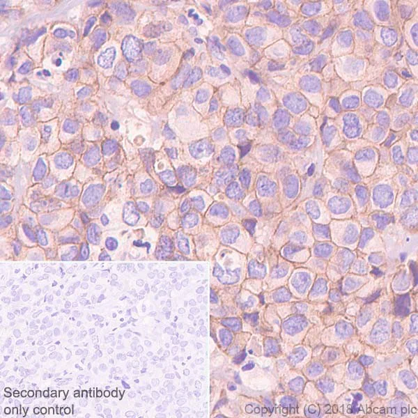 Immunohistochemistry (Formalin/PFA-fixed paraffin-embedded sections) - Anti-PI 3 Kinase catalytic subunit alpha/PIK3CA antibody [SP139] (AB135384)