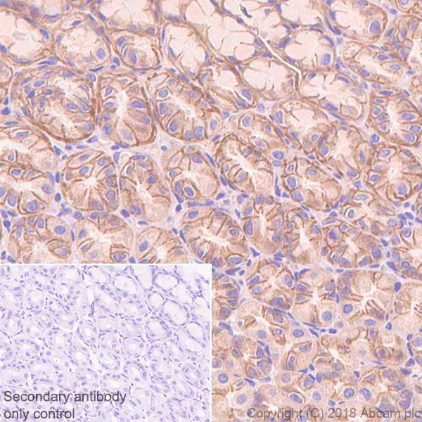 Immunohistochemistry (Formalin/PFA-fixed paraffin-embedded sections) - Anti-PI 3 Kinase catalytic subunit alpha/PIK3CA antibody [SP139] (AB135384)