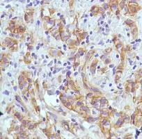 Immunohistochemistry (Formalin/PFA-fixed paraffin-embedded sections) - Anti-PI 3 Kinase catalytic subunit alpha/PIK3CA antibody [SP139] - BSA and Azide free (AB243914)