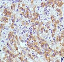 Immunohistochemistry (Formalin/PFA-fixed paraffin-embedded sections) - Anti-PI 3 Kinase catalytic subunit alpha/PIK3CA antibody [SP139], prediluted (AB135371)