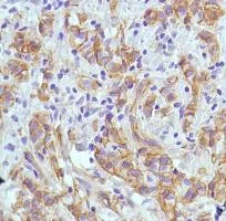 Immunohistochemistry (Formalin/PFA-fixed paraffin-embedded sections) - Anti-PI 3 Kinase catalytic subunit alpha/PIK3CA antibody [SP139], prediluted (AB135371)