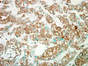 Immunohistochemistry (Formalin/PFA-fixed paraffin-embedded sections) - Anti-PI 3 Kinase catalytic subunit gamma/PI3K-gamma antibody (AB154598)