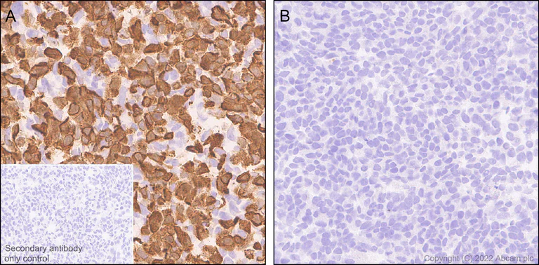 Immunohistochemistry - Anti-PI 3 Kinase catalytic subunit gamma/PI3K-gamma antibody [EPR25156-60] - BSA and Azide free (AB302959)