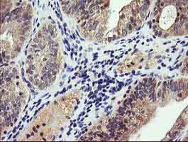 Immunohistochemistry (Formalin/PFA-fixed paraffin-embedded sections) - Anti-PI 3 Kinase catalytic subunit gamma/PI3K-gamma antibody [OTI4G10] (AB140307), expandable thumbnail