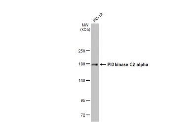 Western blot - Anti-PI 3 Kinase Class 2A/Cpk antibody [HL1612] - BSA and Azide free (AB313861), expandable thumbnail