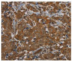 Immunohistochemistry (Formalin/PFA-fixed paraffin-embedded sections) - Anti-PI 3 Kinase p110 delta antibody (AB200372)