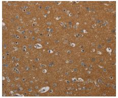Immunohistochemistry (Formalin/PFA-fixed paraffin-embedded sections) - Anti-PI 3 Kinase p110 delta antibody (AB200372)