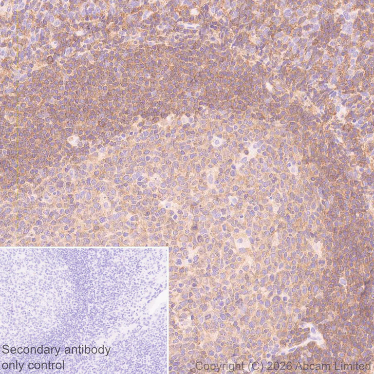 Immunohistochemistry (Formalin/PFA-fixed paraffin-embedded sections) - Anti-PI 3 Kinase p110 delta antibody [EPR30972-532] (AB327424)