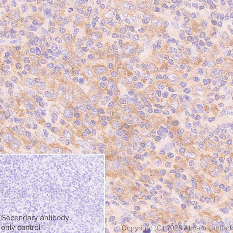 Immunohistochemistry (Formalin/PFA-fixed paraffin-embedded sections) - Anti-PI 3 Kinase p110 delta antibody [EPR30972-532] (AB327424)