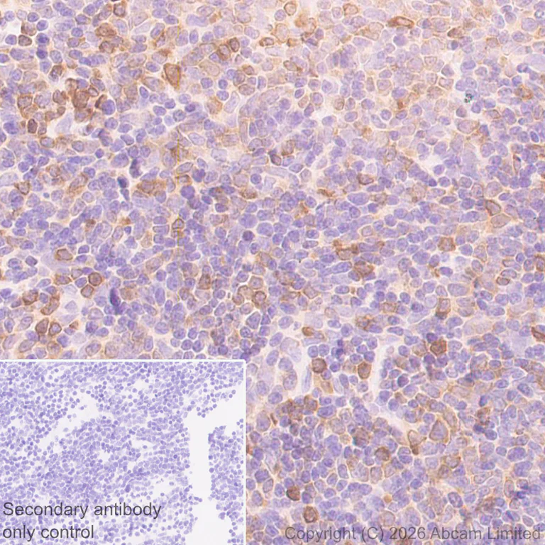 Immunohistochemistry (Formalin/PFA-fixed paraffin-embedded sections) - Anti-PI 3 Kinase p110 delta antibody [EPR30972-532] (AB327424)