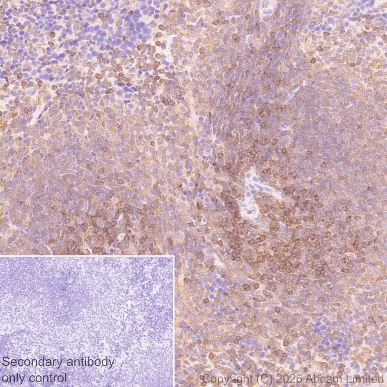 Immunohistochemistry (Formalin/PFA-fixed paraffin-embedded sections) - Anti-PI 3 Kinase p110 delta antibody [EPR30972-532] (AB327424)
