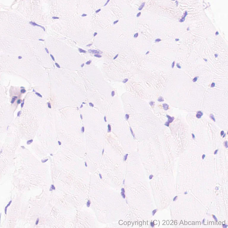 Immunohistochemistry (Formalin/PFA-fixed paraffin-embedded sections) - Anti-PI 3 Kinase p110 delta antibody [EPR30972-532] (AB327424)