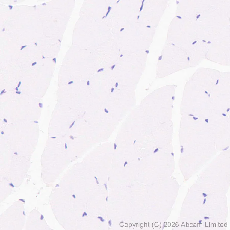 Immunohistochemistry (Formalin/PFA-fixed paraffin-embedded sections) - Anti-PI 3 Kinase p110 delta antibody [EPR30972-532] (AB327424)