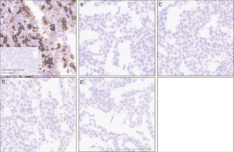 Immunohistochemistry (Formalin/PFA-fixed paraffin-embedded sections) - Anti-PI 3 Kinase p110 delta antibody [EPR30972-532] (AB327424)