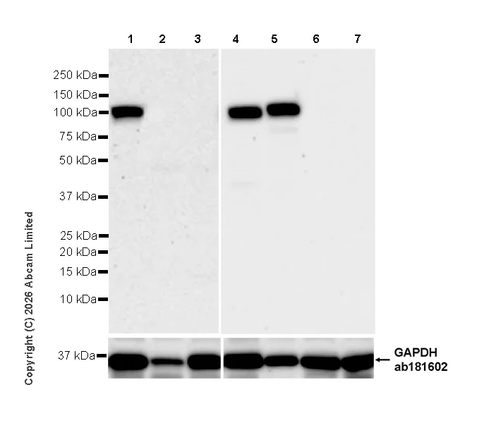 Western blot - Anti-PI 3 Kinase p110 delta antibody [EPR30972-532] (AB327424)