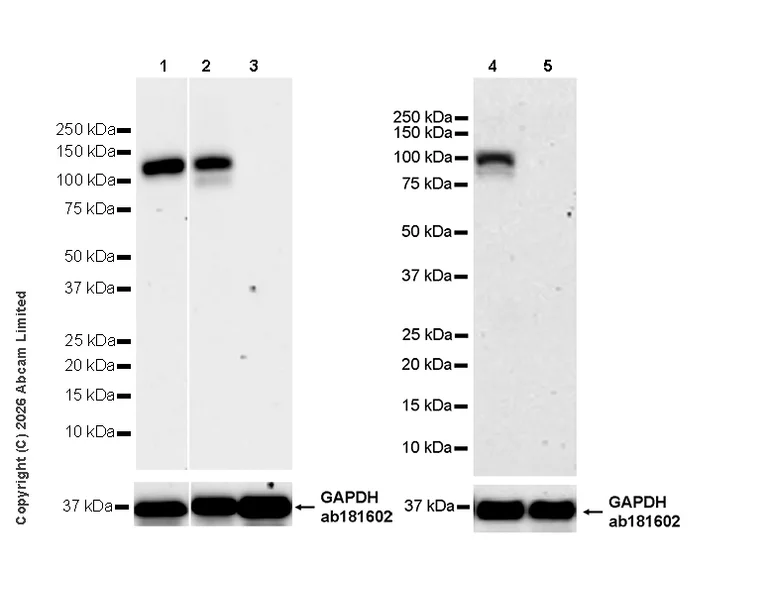 Western blot - Anti-PI 3 Kinase p110 delta antibody [EPR30972-532] (AB327424)