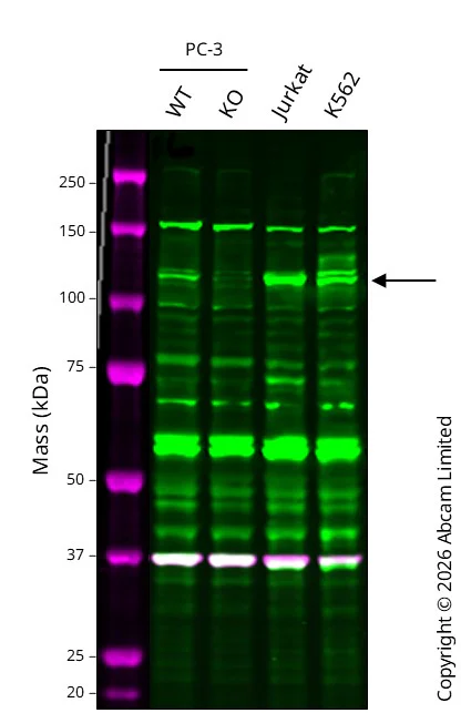 Western blot - Anti-PI 3 Kinase p110 delta antibody [Y387] (AB32401)