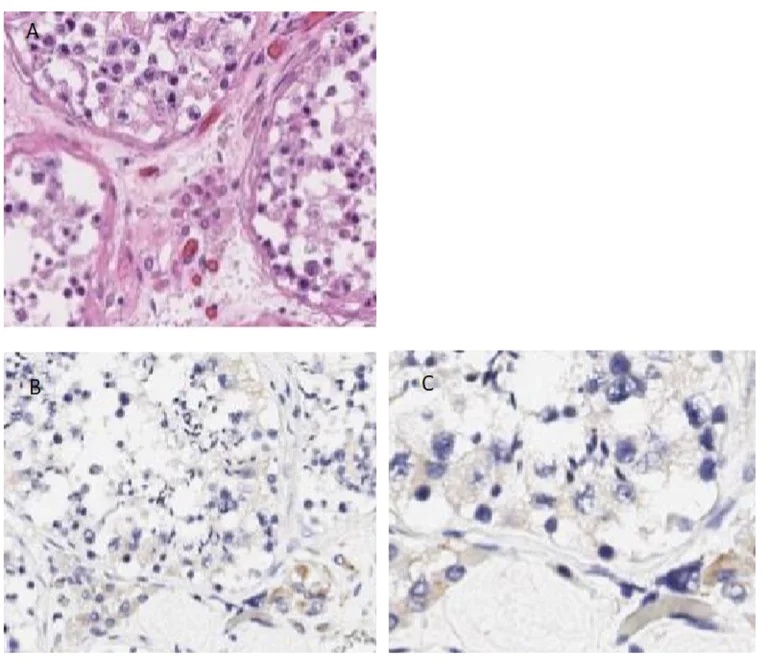 Immunohistochemistry (Formalin/PFA-fixed paraffin-embedded sections) - Anti-PI 3 Kinase p55 gamma antibody (AB235234)