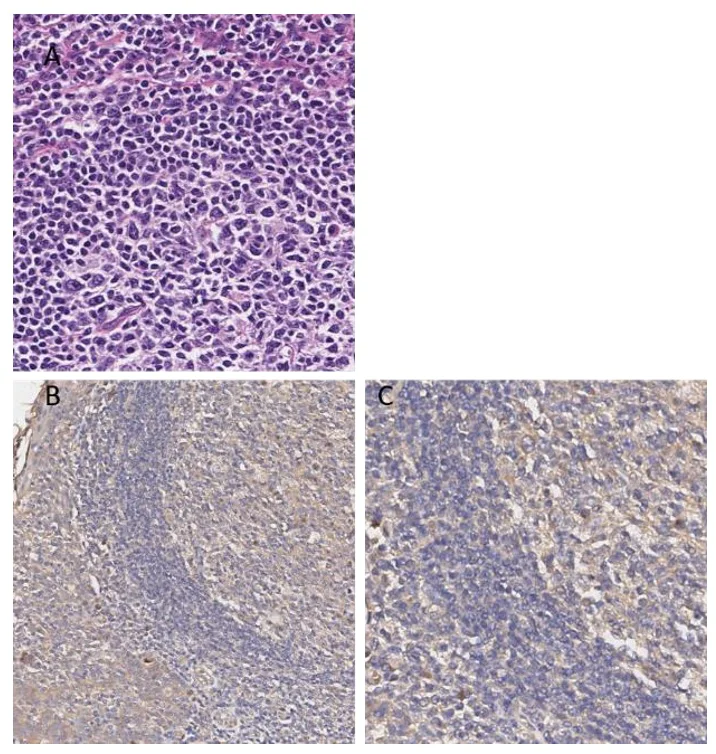 PI 3 Kinase p55 gamma (H5) Rabbit mAb