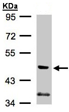 Western blot - Anti-PI 3 Kinase p55 gamma antibody (AB97862), expandable thumbnail