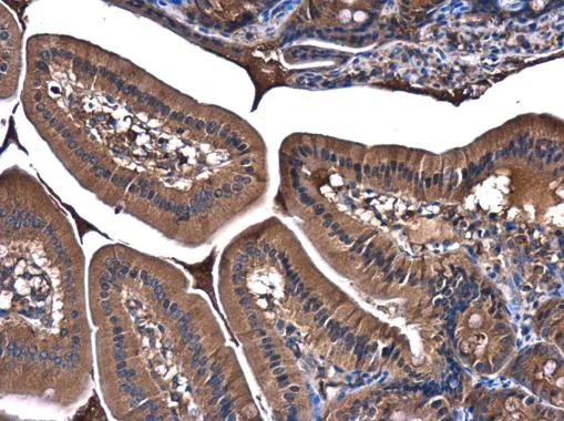 Immunohistochemistry (Formalin/PFA-fixed paraffin-embedded sections) - Anti-PI 3 Kinase p85 alpha antibody (AB227204)