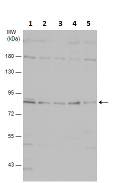 Western blot - Anti-PI 3 Kinase p85 alpha antibody (AB227204), expandable thumbnail