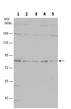 Western blot - Anti-PI 3 Kinase p85 alpha antibody (AB227204)