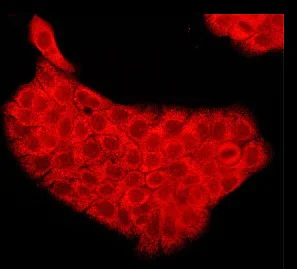 Immunocytochemistry/ Immunofluorescence - Anti-PI 3 Kinase p85 alpha antibody [M253] (AB86714)