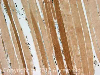 Immunohistochemistry (Formalin/PFA-fixed paraffin-embedded sections) - Anti-PI 3 Kinase p85 alpha antibody [M253] (AB86714)