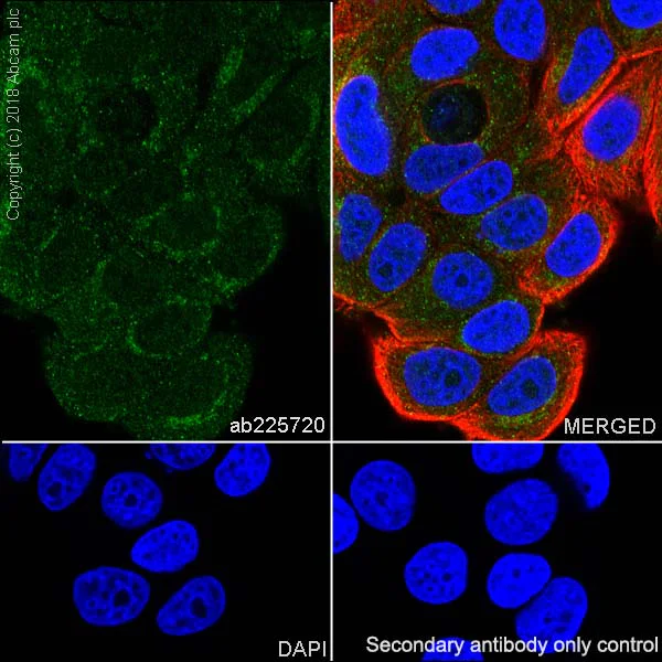Immunocytochemistry/ Immunofluorescence - Anti-PI 3 Kinase p85 alpha antibody [SP62] (AB225720)