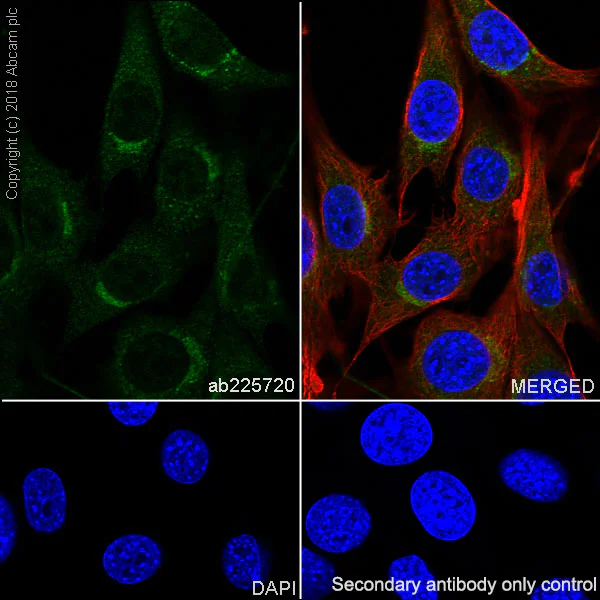 Immunocytochemistry/ Immunofluorescence - Anti-PI 3 Kinase p85 alpha antibody [SP62] (AB225720)