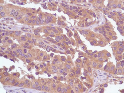 Immunohistochemistry (Formalin/PFA-fixed paraffin-embedded sections) - Anti-PI 3 Kinase p85 alpha antibody [SP62] (AB225720)
