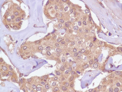 Immunohistochemistry (Formalin/PFA-fixed paraffin-embedded sections) - Anti-PI 3 Kinase p85 alpha antibody [SP62] (AB225720)